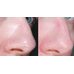 Ciracle Pore Control Tightening Sheet