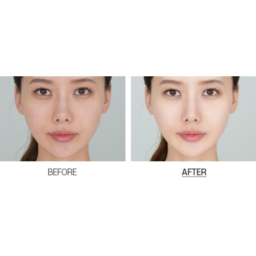 Medi-Peel Niacinamide W3 Toning Spot Cream