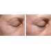 Medi-Peel Peptide-Tox 5 Peptide Bor Multi Care Kit