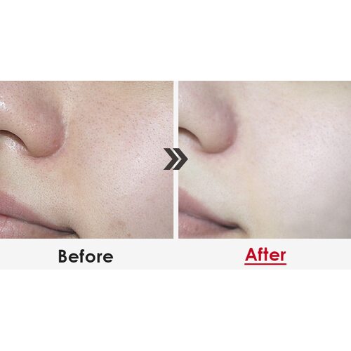 Medi-Peel Aesthe Derma Lacto Collagen Clear
