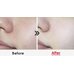 Medi-Peel Aesthe Derma Lacto Collagen Clear