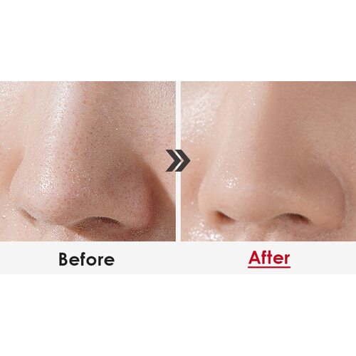 Medi-Peel Aesthe Derma Lacto Collagen Clear
