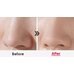 Medi-Peel Aesthe Derma Lacto Collagen Clear