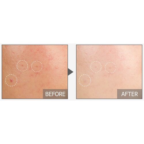 Tiam My Signature Red C Serum