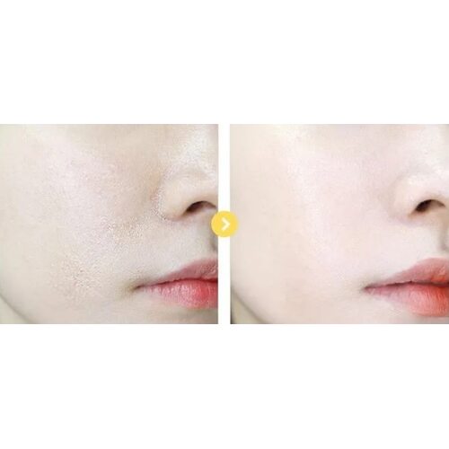 Graymelin Pineapple Mild Peeling Gel