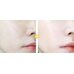 Graymelin Pineapple Mild Peeling Gel