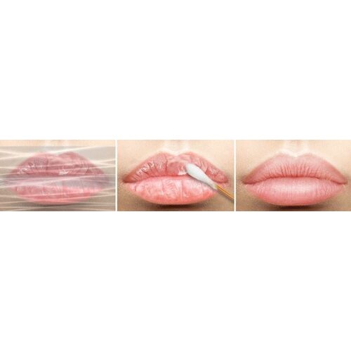 Mediheal Labocare Panteno Lips Healssence