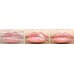 Mediheal Labocare Panteno Lips Healssence