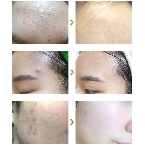 Blithe Patting Splash Mask Soothing & Healing Green tea