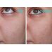 MediHeal P.D.F AC-Dressing Ampoule Mask