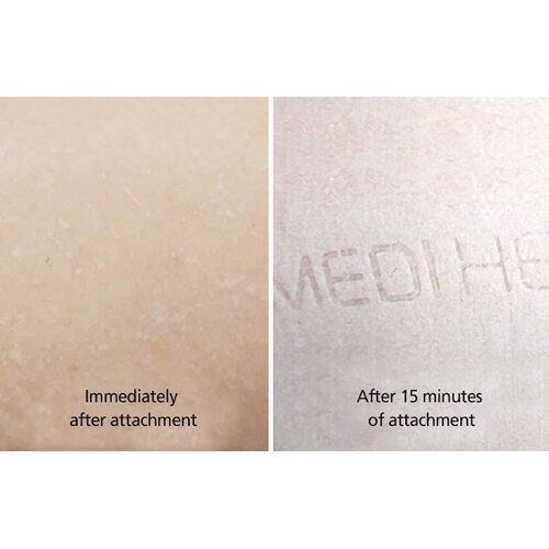 MediHeal I.P.I Lightmax Ampoule Mask EX