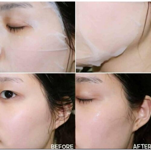MediHeal Platinum V-Life Essential Mask