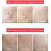 Tiam AC Fighting Spot Rx Cream