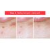 Tiam AC Fighting Spot Rx Cream
