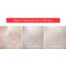Tiam AC Fighting Spot Rx Cream