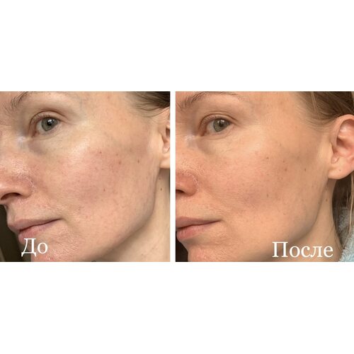 Trimay Vita Tree Niacinamide Me Back Cream