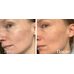Trimay Vita Tree Niacinamide Me Back Cream