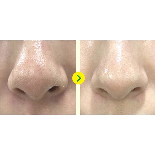 Somebymi Yuja Niacin Brightening Peeling Gel