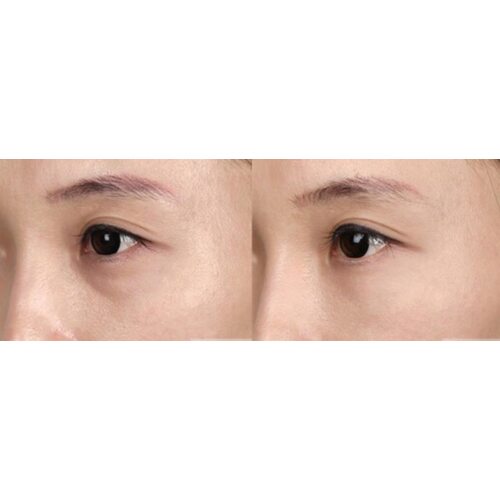Mary&May Tranexamic Acid+ Glutathion Eye Cream