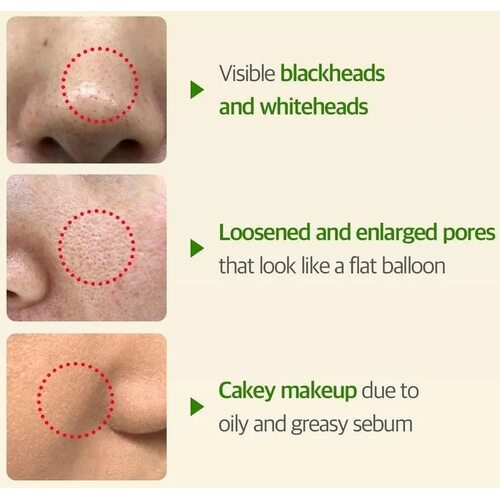 Some By Mi Super Matcha Pore Care Starter Kit