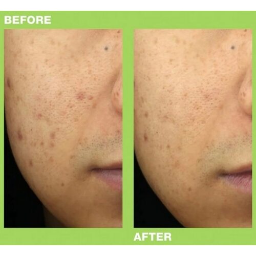 Dr.Jart+ Ctrl-A Teatreement Moisturizer