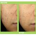 Dr.Jart+ Ctrl-A Teatreement Moisturizer