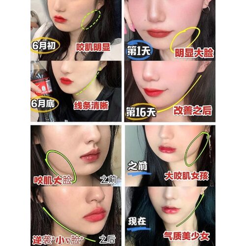 Wonjin Effect V-Up Advanced Tension Mask