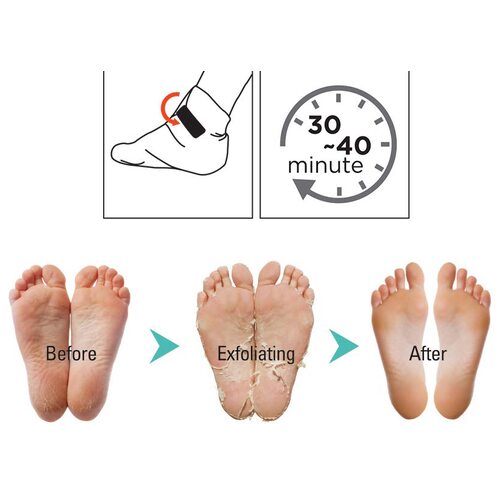 Epielle Foot Peeling Mask