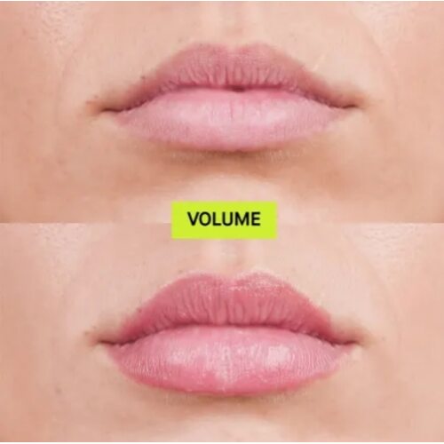 Transparent Lab Volume Hydro Plump Lip Augmentation