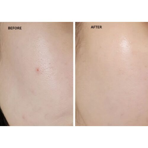 By Wishtrend Mandelic Acid Gentle Exfoliating Toner