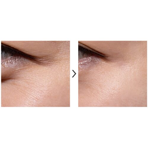 Tiam Vita A Bakuchiol Firming Eye Cream
