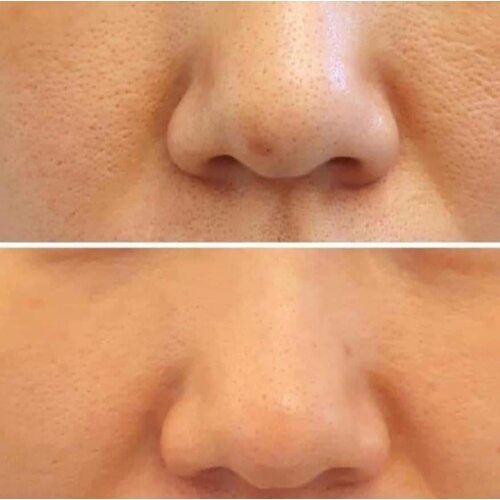 Derma Factory Niacinamide 20% Serum