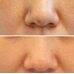 Derma Factory Niacinamide 20% Serum