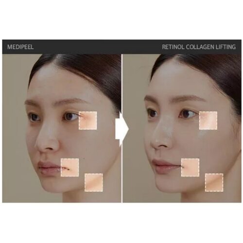 Medi-Peel Retinol Collagen Lifting Ampoule