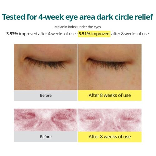 Goodal Green Tangerine Vita-C Dark Circle Eye Cream