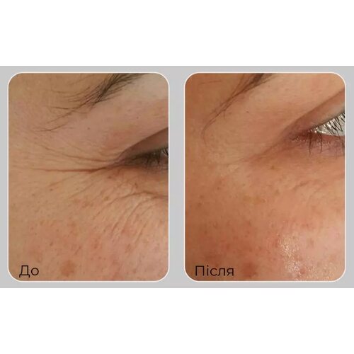 Medi-Peel Peptide 9 Volume Lifting Eye Patch Pro