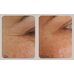 Medi-Peel Peptide 9 Volume Lifting Eye Patch Pro