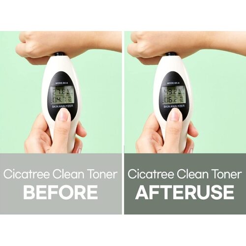 Mixsoon Cicatree Clean Toner