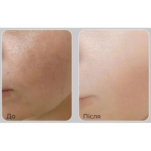 Medi-Peel Peptide 9 Vitanol Cream Pro
