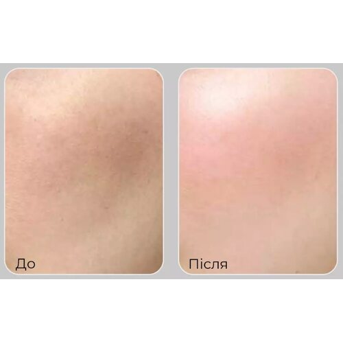 Medi-Peel Peptide 9 Volume Bio Tox Trial Kit