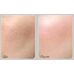 Medi-Peel Peptide 9 Volume Bio Tox Trial Kit