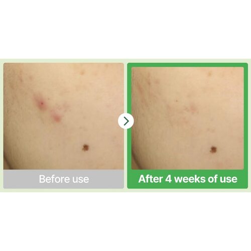 Torriden Balanceful Cica Cream