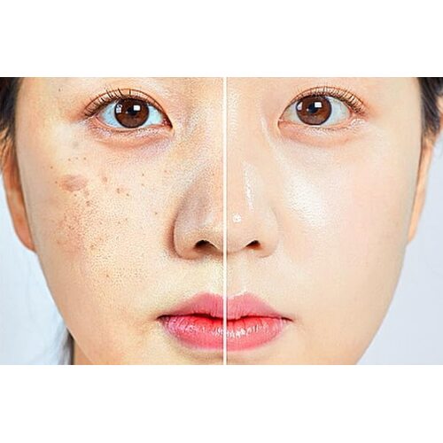 Derma Factory Matrixyl 15% Multi Wrinkle Serum