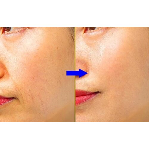 Derma Factory Matrixyl 15% Multi Wrinkle Serum