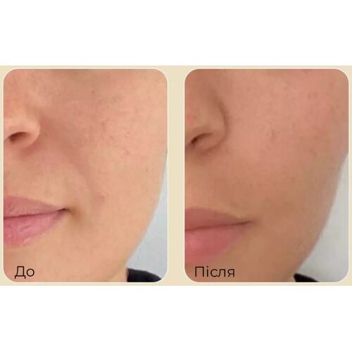 Medi-Peel Premium Golden Camellia Wrinkle Cream