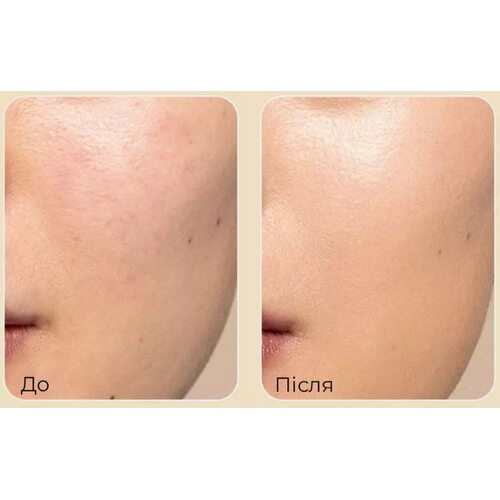 Medi-Peel Premium Golden Camellia Wrinkle Essence