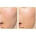 Medi-Peel Premium Golden Camellia Wrinkle Essence