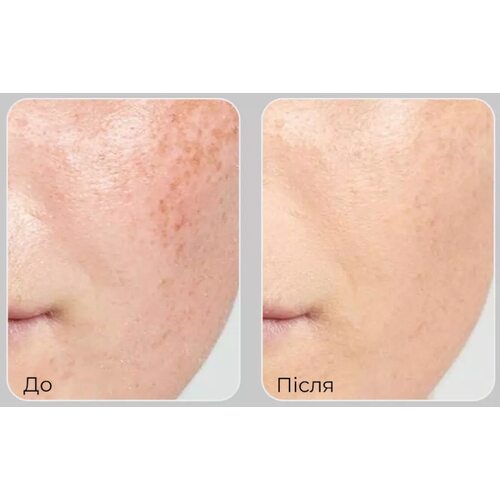 Medi-Peel Peptide 9 Vitanol Ampoule Pro