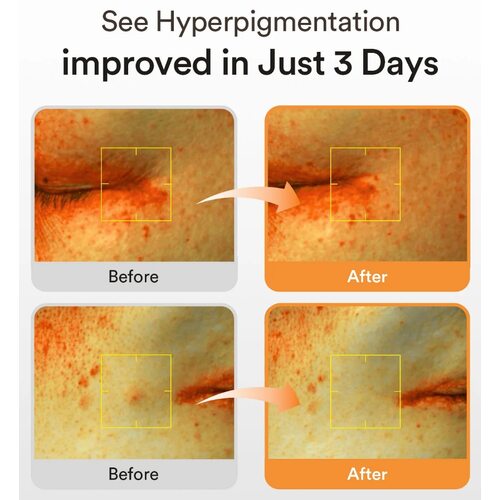 Abib Glutathiosome Dark Spot Serum Vita Drop