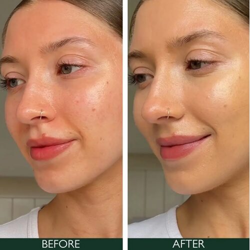 Sorted Skin 5 In 1 Anti-Redness Day Cream